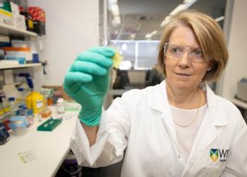 Professor Clare Scott at WEHI is leading the research into immune responses in ovarian cancer patients